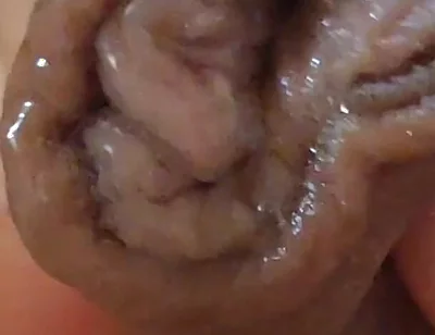 Large Foreskin and Balls in Striking Close-up.