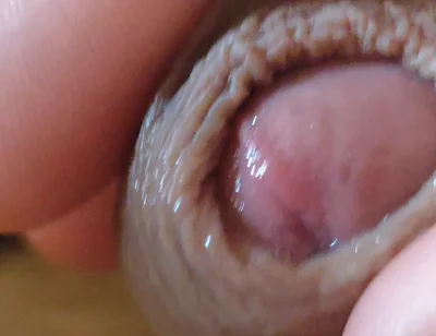 Large Foreskin and Balls in Striking Close-up.