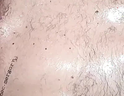 Stillness and Skin