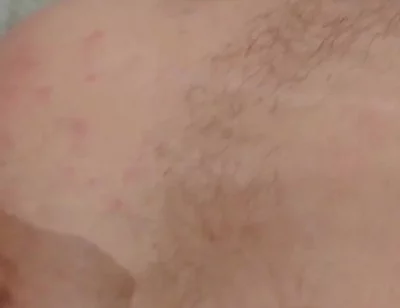 Masturbation