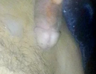 Boy Roasts His Straw and Smears It All Over His Stomach at Night While His Parents Are Away