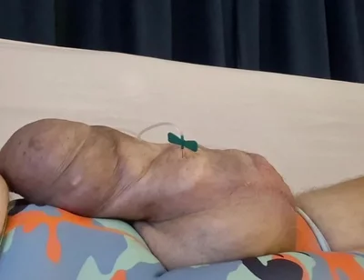 What a Big Obscene Package of Silicone Meat