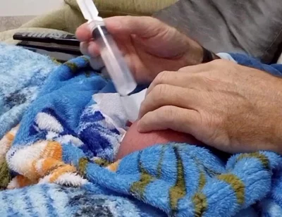 60cc Saline Injection in Each Egg