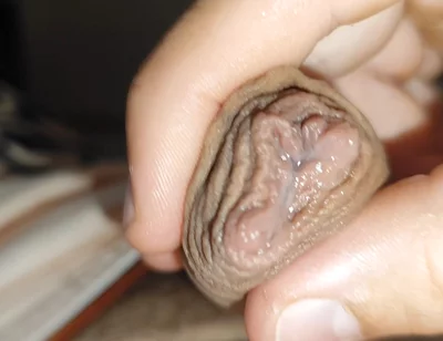 Silent Purge of Straight Scrotal Fluid.