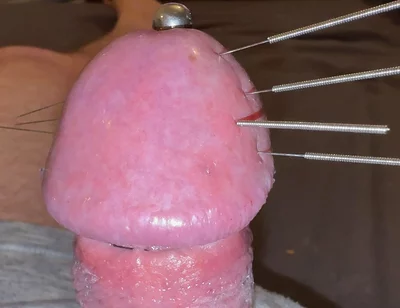 Needles Through the Thick, Hard Glans, Mega Orgasm