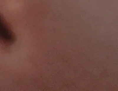 Amazing Closeup of the Widened Hole!!