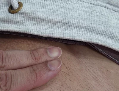 The Hair on My Penis - Led Hair Removal