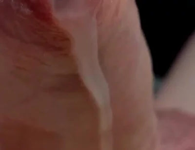 Phimosis Cock Leaking Cum Close-up Hands-free