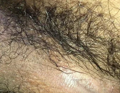 I Need You to Put Your Penis in I Can't Stand This Fever Anymore