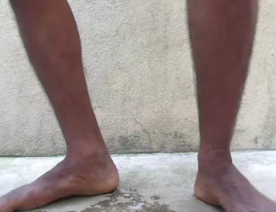 Mature Hairy Indian Cock Hair Removel After Oil Masturbation to Release Cum