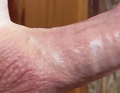 Small Hairless Virgin Phimosis Dick Braves the Cold for Some Hands-free Edging and Leaking Cum