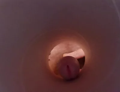 Tunnel Vision