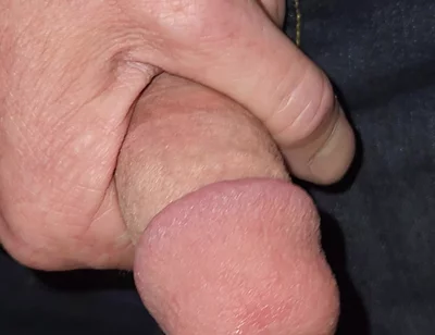 Gaping Urethra - Marker and Pinky Insertion
