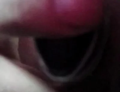 Fisting