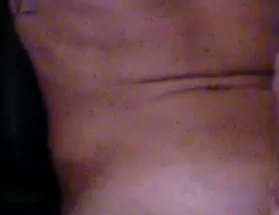 Xfroskax