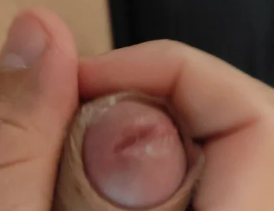 Amazing Pre Cum Glans.
