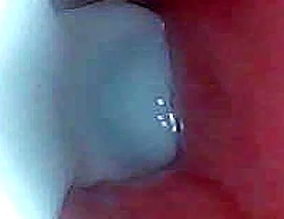 I Couldn’t Believe What Happens Inside the Penis as Sperm Passes Through (endoscopic Footage)