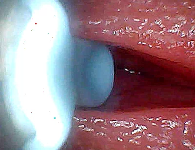I Couldn’t Believe What Happens Inside the Penis as Sperm Passes Through (endoscopic Footage)