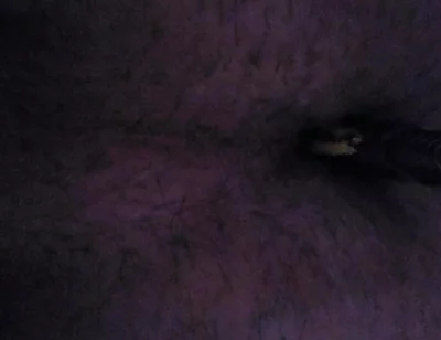 I'm Sticking a Razor Blade up My Ass.
