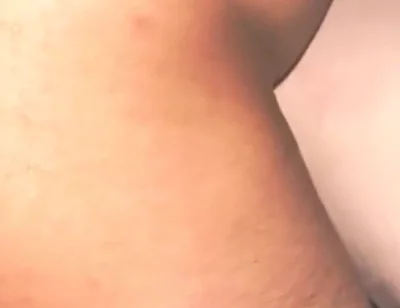 Smooth Skin