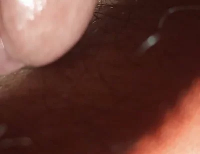 Super Anal