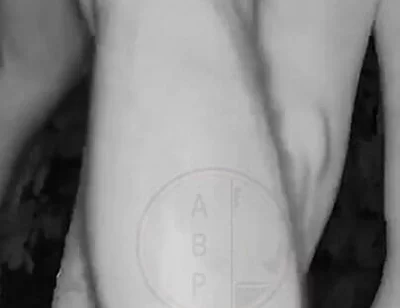 In a Park, at Night, Jules Is Desperate to Pee and Tries to Hide From His Friend but Is Caught on Night Vision Cam