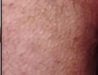 Split-screen Twitching Asshole Dripping with Massive Cum Load