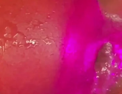What a Blow Hole