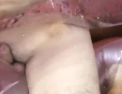 Inflatable lips