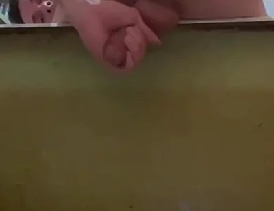 Masturbating a Cock and a Protruding Prolapse