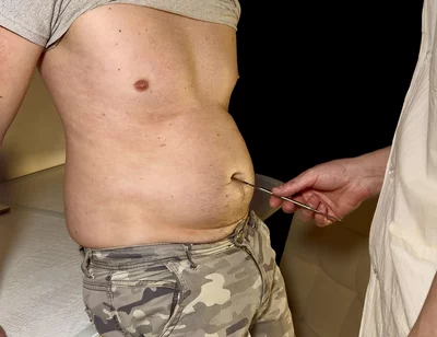 Swollen Perfection - Private Check-up