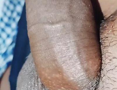 Penis