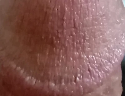My Dick