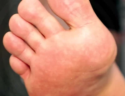 Golden Foot Bath for Pigs