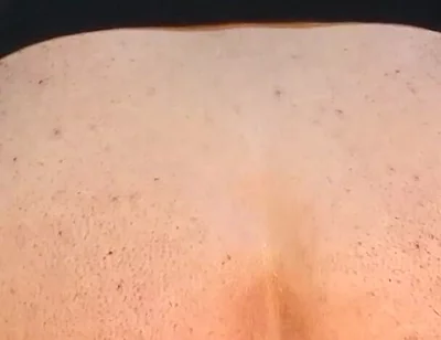 He Enjoys Sucking on His Anal Prolapse