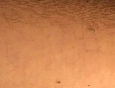 Hard Anal Fisting in Pantyhose