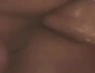 Gaping Anal Prolapse Overflow - Rosebud Pulsing Wide Open