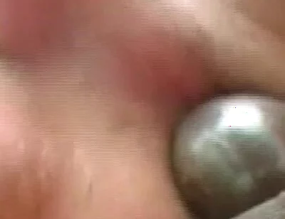 Gaping Anal Rosebud Prolapsing After Deep Stretching Session