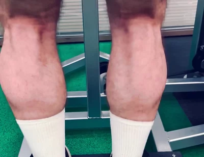 My Legs