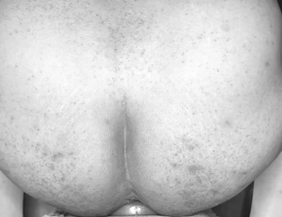 Extreme Anal Plug