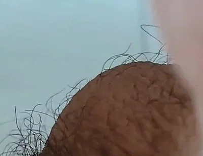 Extreme Open Hole Leaves the Glans Exposed.