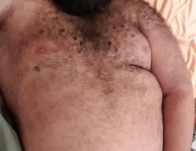 Trying to Rest