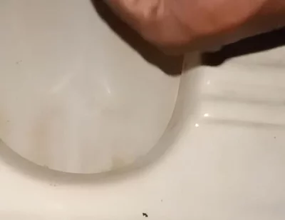 Urinating From the Penis