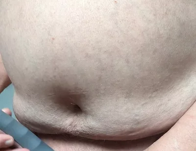 Shave and Suck