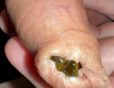 Juicy Small Cock Foreskin Games