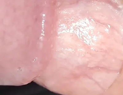 Incredible Cock, Unique of Slippery Phimosis by the Robust Body.