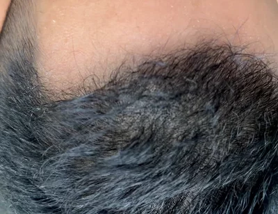 Naked Mountain Climbing and Masturbation