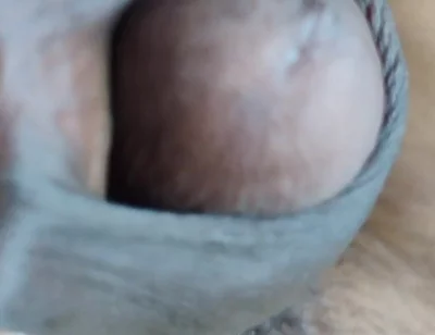 My Penis