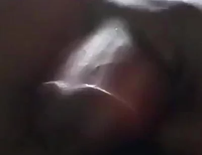 Sperm