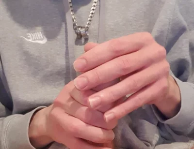 Skinny Lad Pulls Back Skin to Show Bellend